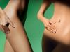 Cum scapi de celulită? Află de la un medic specialist dermatolog şi de la Oana Cuzino!