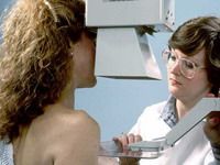 Nivelul de estrogen „prezice” recurenţa cancerului mamar