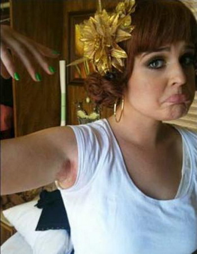 Kelly Osbourne, arsuri grave de la un spray de corp!