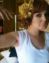 Kelly Osbourne, arsuri grave de la un spray de corp!