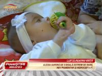 O fetita de numai patru luni, diagnosticata cu hidrocefalie si nev pigmentar, are nevoie de ajutor pentru tratament!