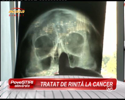 Acuzatie de malpraxis! Un barbat spune ca medicul ORL-ist l-a diagnosticat cu rinita, desi avea cancer! VIDEO