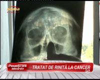 Acuzatie de malpraxis! Un barbat spune ca medicul ORL-ist l-a diagnosticat cu rinita, desi avea cancer! VIDEO
