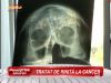 Acuzatie de malpraxis! Un barbat spune ca medicul ORL-ist l-a diagnosticat cu rinita, desi avea cancer! VIDEO