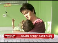 O fetita nascuta fara nas, gura si cateva degete e ingrijita de medicii si asistentele de la spitalul Marie Curie - VIDEO