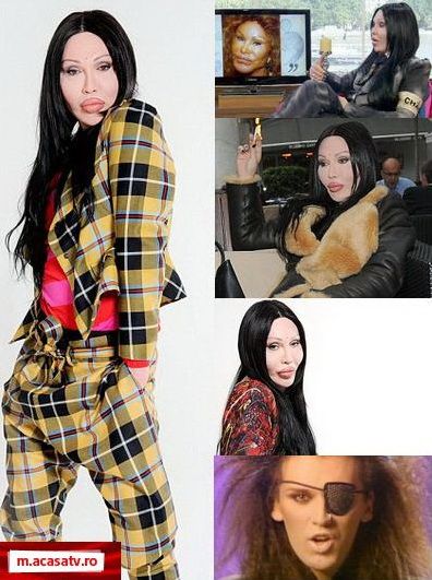 Pete Burns, dupa mai mult  de 100 de operatii estetice:  „Fata mea  era pe cale sa cada"