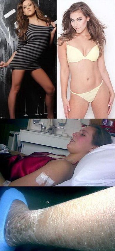 O adolescenta care si-a rupt coloana intr-un accident concureaza la „Miss Marea Britanie 2010”