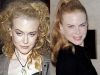 Nicole Kidman marturiseste: „Am folosit injectii cu Botox”