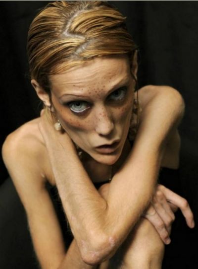 S-a sinucis mama lui Isabelle Caro, modelul care a murit de anorexie 