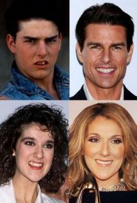 Dintii vedetelor, ATUNCI si ACUM! Vezi ce minuni poate face estetica dentara!