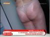 Top vedete autohtone lovite de celuita - VIDEO
