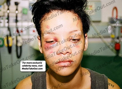 Chris Brown da vina pe Satana pentru noile poze cu Rihanna batuta care au aparut pe net! 