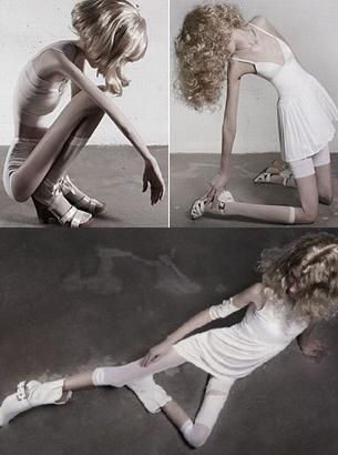 Anorexica HOT? In niciun caz! 