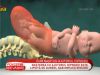 Cat de eficienta este nasterea cu ajutorul hipnozei - VIDEO