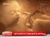 Socant: Un barbat sustine ca sotia lui a avortat neasistata la maternitatea Giulesti - VIDEO