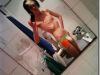 Tanar anorexic: Corpul meu a ajuns sa se manance singur pe interior