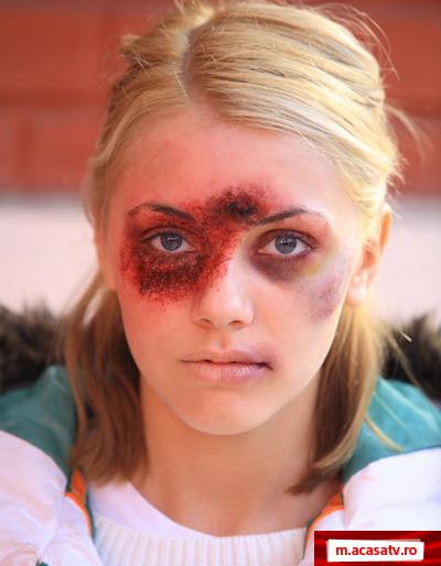 Andreea Patrascu – cu chipul desfigurat in “Iubire si onoare” - FOTO