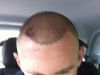 Primele POZE cu Rooney dupa operatia de implant de PAR!