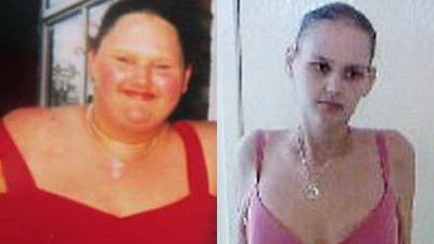 De la supraponderala la anorexica! Povestea unei adolescente in pericol sa isi piarda viata!