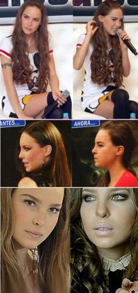 Belinda vrea sa-si faca o noua operatie estetica la nas. Crezi ca are nevoie?