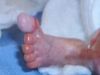 Bebelusul care s-a nascut FARA PIELE. "Doctorii aproape ca ii puteau vedea CREIERUL