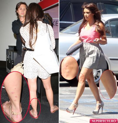 	Kim Kardashian nu se lasa invinsa de boala de piele: poarta in continuare fuste scurte! FOTO