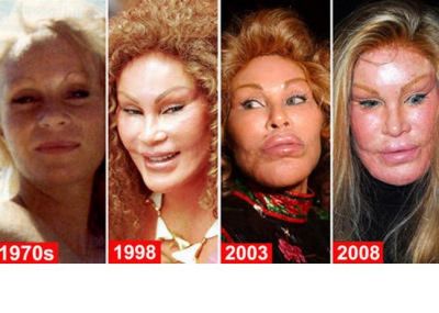 Cum au transformat-o operatiile estetice pe Jocelyn Wildenstein dintr-o femeie frumoasa in cea mai infricosatoare celebritate &nbsp;