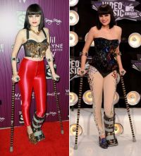 Jessie J - cu piciorul in ghips, accesorizat cu cristale, la premiile VMA