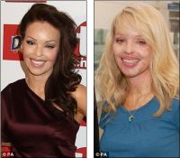 Katie Piper redevine o tanara incantatoare, dupa ce a fost violata si arsa cu acid sulfuric de fostul prieten - FOTO
