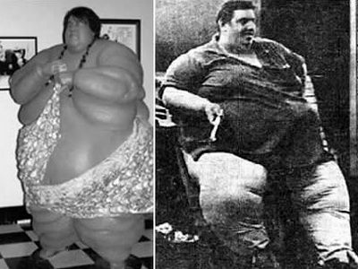 A slabit 420kg ca sa supravietuiasca 