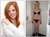 Avea 30 de kilograme si manca numai bomboane fara zahar -  Povestea unei tinere care a invins anorexia - FOTO