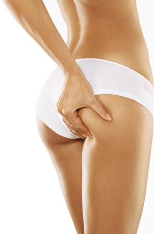 Cum sa scapi de celulita in mod natural? O femeie din SUA a gasit solutia!