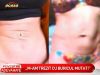 Si-a facut operatie de abdominoplastie, dar a ramas mutilata pe viata - VIDEO