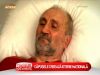 Muscatura de capusa creeaza isterie nationala! Afla ce zone de pe corp sunt usor accesibile capuselor - VIDEO