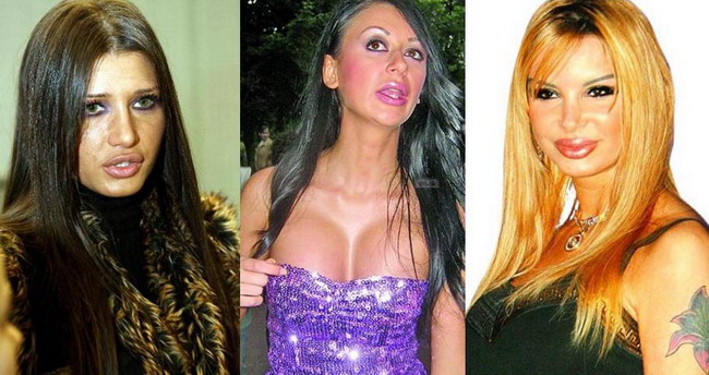 In cautarea buzelor perfecte. Care sunt cele mai nereusite? FOTO!
