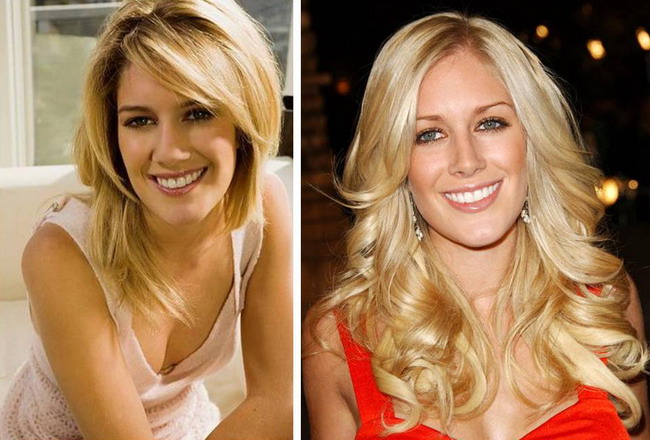Heidi Montag si-a facut 10 operatii estetice intr-o zi