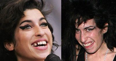 Ati ghicit! Dantura din imagine este a lui Amy Winehouse!