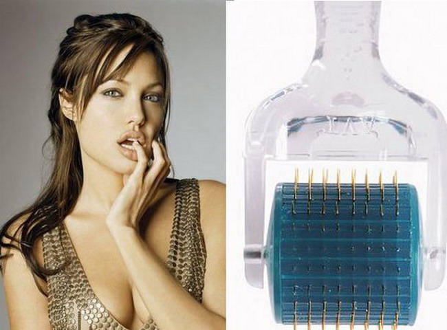 Vrei sa ai o piele perfecta fara sa dai milioane la cosmetica? Inspira-te de la Angelina Jolie si foloseste Dermaroller!