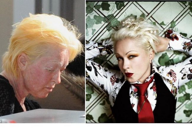 Cindy Lauper, imaginea cosmeticelor MAC, cu fața distrusa! FOTO