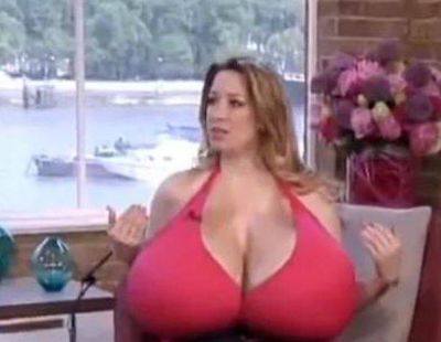 Vezi incredibila poveste a unei femei cu sanii de 24 de kilograme - VIDEO