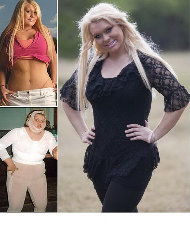 La numai 12 ani si-a facut liposuctie, iar pana la 17 si-a pus inel gastric si silicoane...ca sa arate ca papusa Barbie!
