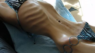 IMAGINI CUTREMURATOARE: Frumuseti mutilate de ANOREXIE