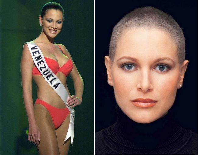 Fosta Miss Venezuela a murit de cancer mamar la doar 28 de ani